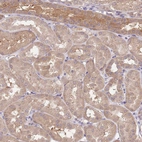 Immunohistochemical staining of human kidney shows moderate cytoplasmic positivity in cells in tubules.