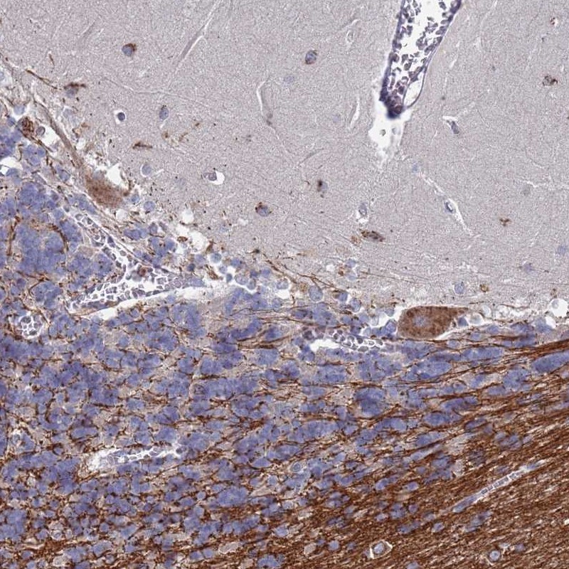 Anti-TCEANC2 Antibody