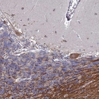 Anti-TCEANC2 Antibody