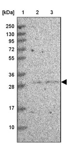 Lane 1: Marker [kDa] 250, 130, 95, 72, 55, 36, 28, 17, 10_br/_Lane 2: Human cell line RT-4_br/_Lane 3: Human cell line U-251MG sp