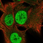 Immunofluorescent staining of human cell line SK-MEL-30 shows localization to nucleoplasm & vesicles.