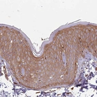 Anti-ACVR2A Antibody