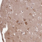Immunohistochemical staining of human cerebral cortex shows moderate to strong cytoplasmic positivity in neurons.