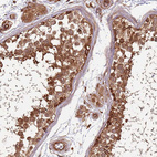 Immunohistochemical staining of human testis shows moderate to strong cytoplasmic positivity in cells in seminiferous ducts.