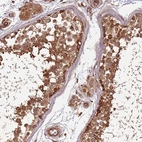 Immunohistochemical staining of human testis shows moderate to strong cytoplasmic positivity in cells in seminiferous ducts.