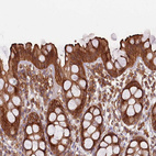 Immunohistochemical staining of human gastrointestinal shows moderate to strong membranous positivity in glandular cells.