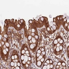 Immunohistochemical staining of human gastrointestinal shows moderate to strong membranous positivity in glandular cells.