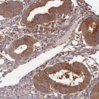 Immunohistochemical staining of human endometrium shows moderate to strong membranous positivity in glandular cells.
