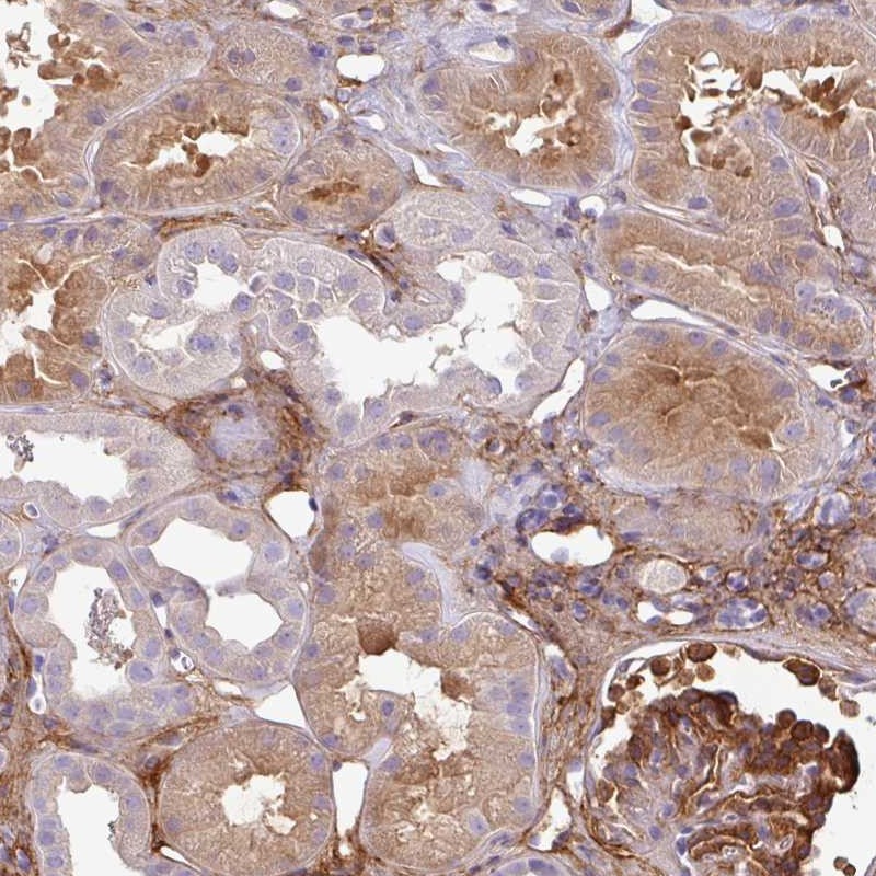 Anti-PARD6G Antibody