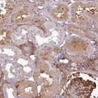 Anti-PARD6G Antibody