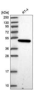 Western blot analysis in human cell line RT-4.