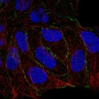 Immunofluorescent staining of human cell line RT4 shows localization to plasma membrane.