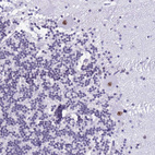Anti-DHX15 Antibody