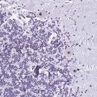 Immunohistochemical staining of human cerebellum shows moderate nuclear positivity in Purkinje cells.