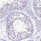 Immunohistochemical staining of human testis shows weak nuclear positivity in cells in seminiferous ducts and in Leydig cells.