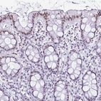 Immunohistochemical staining of human rectum shows moderate nuclear positivity in glandular cells.