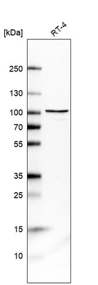 Western blot analysis in human cell line RT-4.