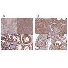 Anti-NSFL1C Antibody