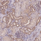 Immunohistochemical staining of human kidney shows moderate cytoplasmic positivity in cells in tubules.