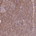 Anti-NSFL1C Antibody