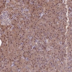 Immunohistochemical staining of human pancreas shows strong nuclear and cytoplasmic positivity in exocrine glandular cells.