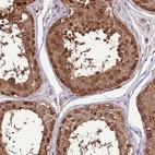 Immunohistochemical staining of human testis shows strong nuclear and cytoplasmic positivity in cells in seminiferous ducts.