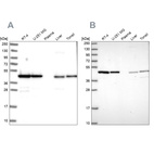 Anti-NSFL1C Antibody