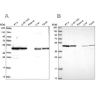 Western blot analysis using Anti-NSFL1C antibody HPA047108 (A) shows similar pattern to independent antibody HPA050628 (B).