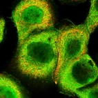 Immunofluorescent staining of human cell line A-431 shows localization to nucleoplasm, plasma membrane & cytosol.