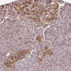 Anti-ST13 Antibody