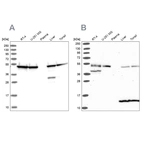 Western blot analysis using Anti-ST13 antibody HPA047114 (A) shows similar pattern to independent antibody HPA046412 (B).