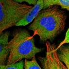 Immunofluorescent staining of human cell line U-2 OS shows localization to cytosol.