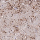 Anti-STK25 Antibody