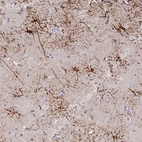 Anti-STK25 Antibody