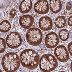 Immunohistochemical staining of human colon shows strong cytoplasmic positivity in glandular cells.