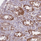 Immunohistochemical staining of human rectum shows strong cytoplasmic positivity in glandular cells.
