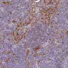 Anti-LGALS9 Antibody