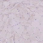 Immunohistochemical staining of human skeletal muscle shows no positivity in myocytes.