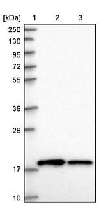 Lane 1: Marker [kDa] 250, 130, 95, 72, 55, 36, 28, 17, 10_br/_Lane 2: Human cell line RT-4_br/_Lane 3: Human cell line U-251MG sp