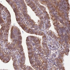 Anti-SCARA3 Antibody