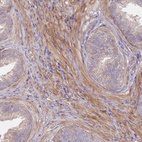 Immunohistochemical staining of human prostate shows strong cytoplasm granular 
 positivity in smooth muscle cells.