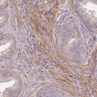 Immunohistochemical staining of human prostate shows strong cytoplasm granular 
 positivity in smooth muscle cells.