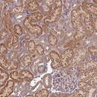 Immunohistochemical staining of human kidney shows strong cytoplasm granular positivity in cells in tubules.