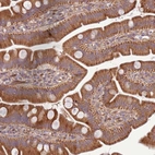Immunohistochemical staining of human small intestine shows strong cytoplasm granular positivity in glandular cells.