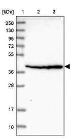 Lane 1: Marker [kDa] 250, 130, 95, 72, 55, 36, 28, 17, 10_br/_Lane 2: Human cell line RT-4_br/_Lane 3: Human cell line U-251MG sp