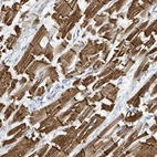 Anti-SIRPB1 Antibody