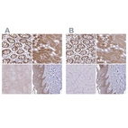Immunohistochemical staining of human colon, kidney, skeletal muscle and skin using Anti-TXN antibody HPA047478 (A) shows similar protein distribution across tissues to independent antibody HPA055752 (B).