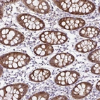 Immunohistochemical staining of human colon shows strong cytoplasmic positivity in glandular cells.