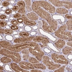 Immunohistochemical staining of human kidney shows strong cytoplasmic positivity in cells in tubules.