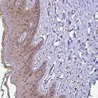 Immunohistochemical staining of human skin shows moderate cytoplasmic and nuclear positivity in squamous epithelial cells.